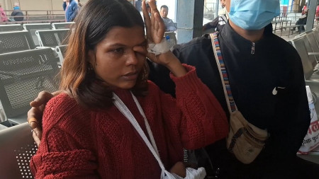 बुटवल आइपुगेकी घाइते यात्रु रिचाई योगी।